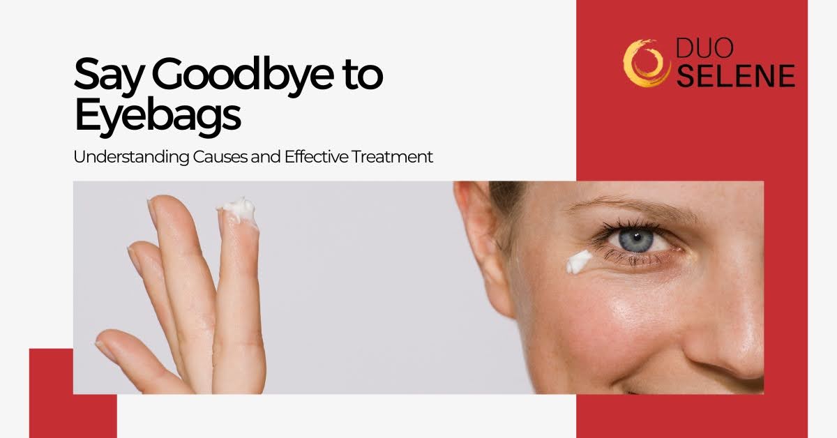  Say Goodbye to Eyebags: Understanding Causes and Effective Treatment